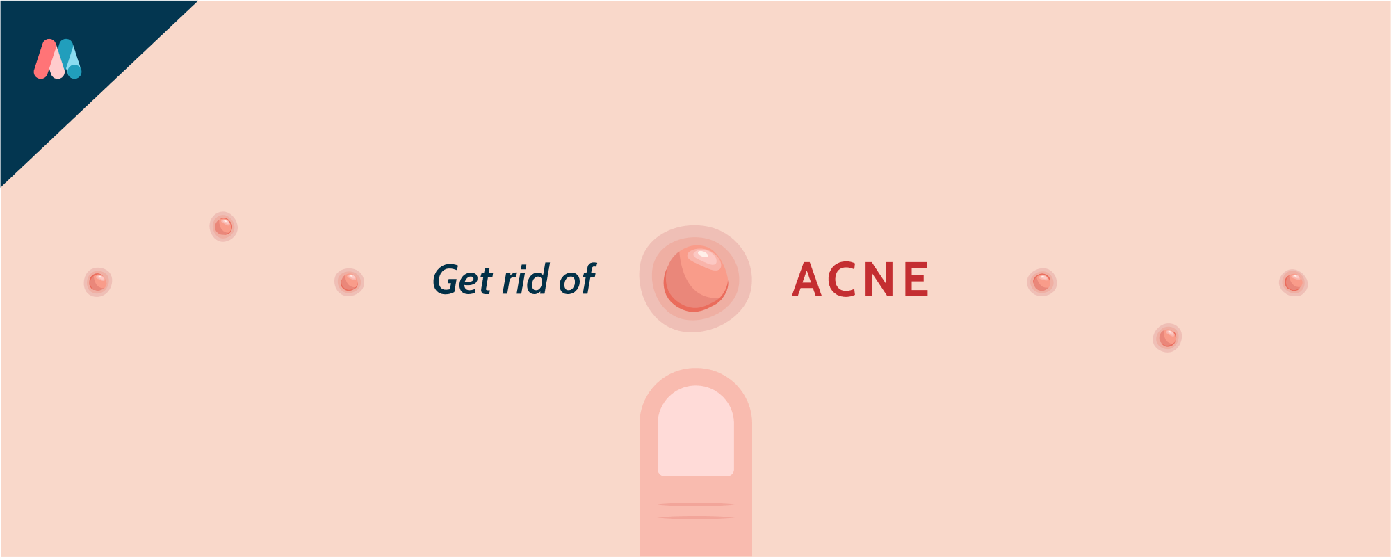 How to get rid of acne